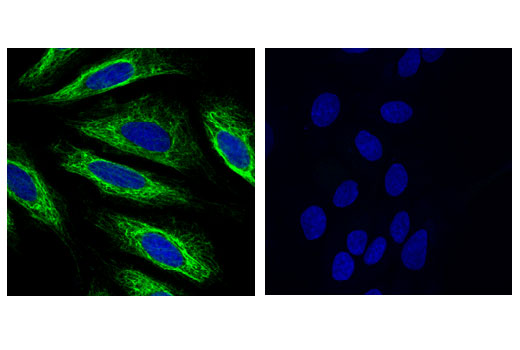 Confocal immunofluorescent analysis of HeLa (positive, left) and HCC827 (negative, right) cells using Keratin 17 (D12E5) XP ® Rabbit mAb (green). Blue pseudocolor= DRAQ5 ® #4084 (fluorescent DNA dye).
