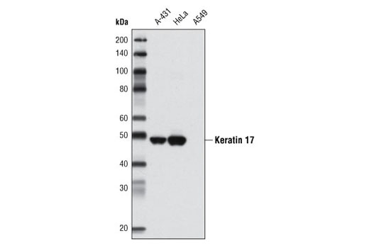 Western blot analysis of extracts from A-431, HeLa, and A549 cells using Keratin 17 (D73C7) Rabbit mAb. As expected, A549 cells are negative for keratin 17.