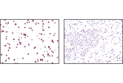 Immunohistochemical analysis of paraffin-embedded MCF-7 cells (positive, left) and A-431 cells (negative, right), using Keratin 19 (BA17) Mouse mAb.