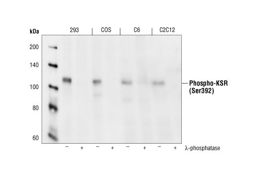Western blot analysis of extracts from HEK293, COS, C6 and C2C12 cells, untreated or lamda phosphatase-treated, using Phospho-KSR1 (Ser392) Antibody.