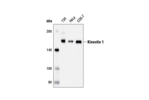 Western blot analysis of extracts from T24, HeLa, and COS-7 cells using Kinectin 1 (D5F7J) Rabbit mAb.