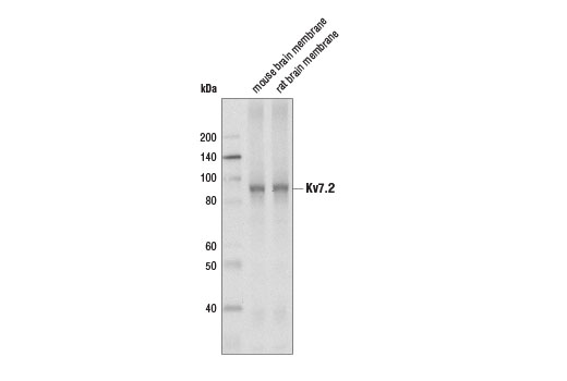 Western blot analysis of extracts from mouse and rat brain membrane using Kv7.2 (D9L5S) Rabbit mAb.