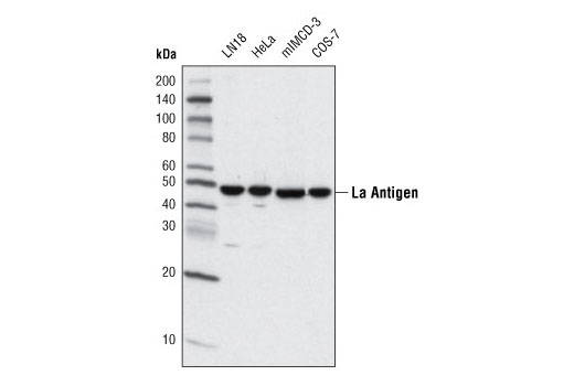 Western blot analysis of extracts from various cell types using La Antigen (D19B3) Rabbit mAb.