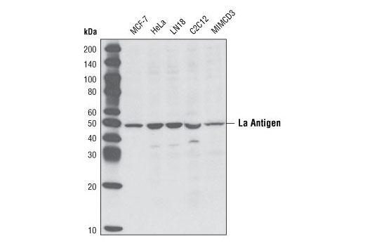 Western blot analysis of extracts from various cell types using La Antigen Antibody.