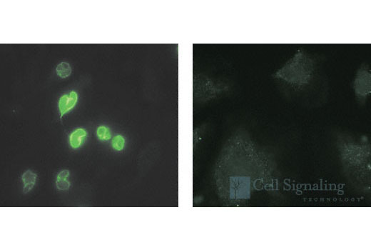 Immunofluorescent analysis of HeLa cells, untreated (right) or staurosporine-treated (left), using Cleaved Lamin A (Small Subunit) (30H5) Mouse mAb.