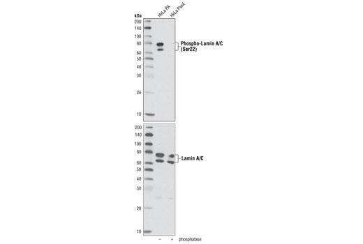 Western blot analysis of extract from G2/M phase HeLa cells untreated or treated with phosphatase, using Phospho-Lamin A/C (Ser22) Antibody (upper) or Lamin A/C Antibody (lower) as loading control.