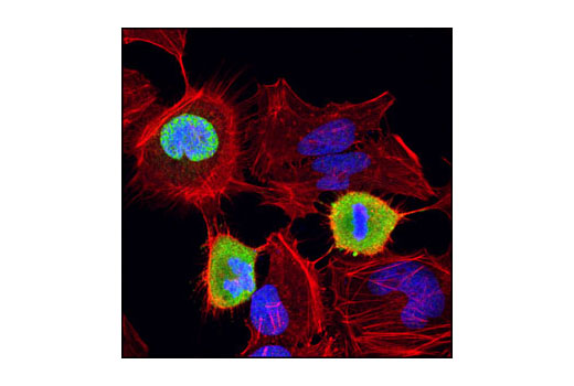 Confocal immunofluorescent analysis of HeLa cells using Phospho-Lamin A/C (Ser22) Antibody (green). Actin filaments have been labeled with DY-554 phalloidin (red). Blue pseudocolor = DRAQ5™ (fluorescent DNA dye).