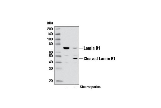 Western blot analysis of extracts from HeLa cells, untreated (-) or treated with Staurosporine #9953 (1 μM, 3 hr; +), using Lamin B1 (D9V6H) Rabbit mAb.