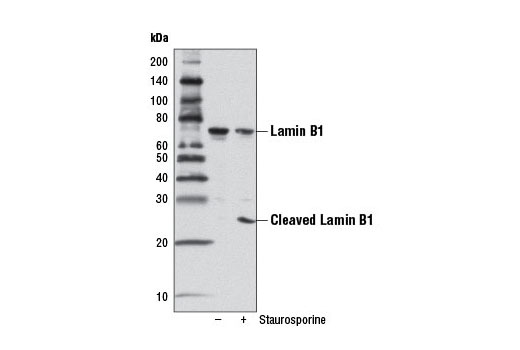 Western blot analysis of extracts from HeLa cells, untreated or treated with Staurosporine #9953 (1 μM, 3 hr), using Lamin B1 (D4Q4Z) Rabbit mAb.