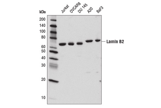 Western blot analysis of extracts from various cell lines using Lamin B2 (E1S1Q) Rabbit mAb.