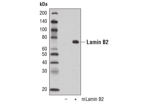 Western blot analysis of extracts from 293T cells, mock transfected (-) or transfected with a construct expressing full-length mouse lamin B2 protein (mLamin B2; +), using Lamin B2 (E1S1Q) Rabbit mAb.