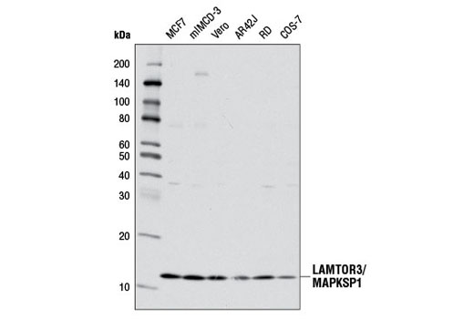Western blot analysis of extracts from various cell lines using LAMTOR3/MAPKSP1 (D38G5) Rabbit mAb.