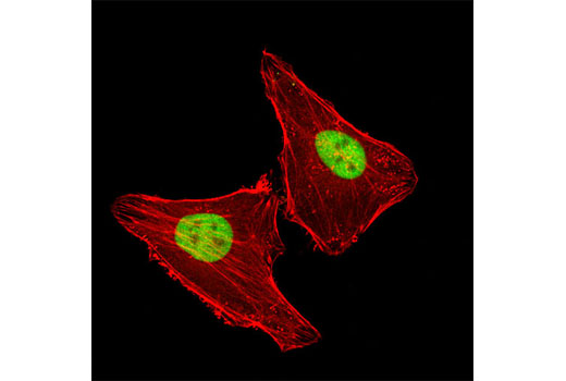 Confocal immunofluorescent analysis of HeLa cells using LAP2alpha (3A3) Mouse mAb (green). Actin filaments have been labeled with DY-554 phalloidin (red).