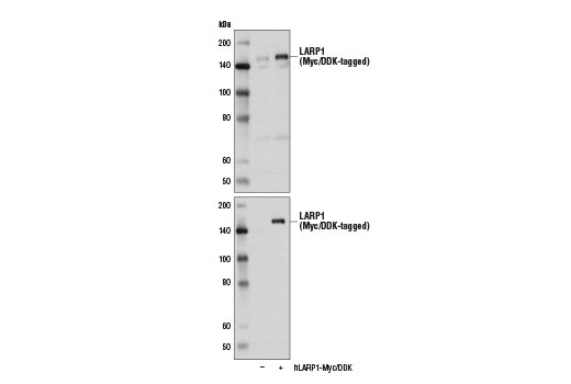 Western blot analysis of extracts from 293T cells, mock transfected (-) or transfected with a construct expressing Myc/DDK-tagged full-length human LARP1 protein (hLARP1-Myc/DDK; +), using LARP1 Antibody (upper) and DYKDDDDK Tag Antibody #2368 (lower).