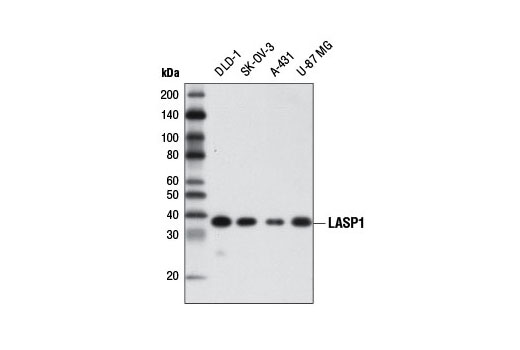 Western blot analysis of extracts from various cell lines using LASP1 Antibody.