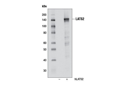 Western blot analysis of extracts from HeLa cells, untransfected (-) or transfected with human LATS2 (+), using LATS2 (D83D6) Rabbit mAb.