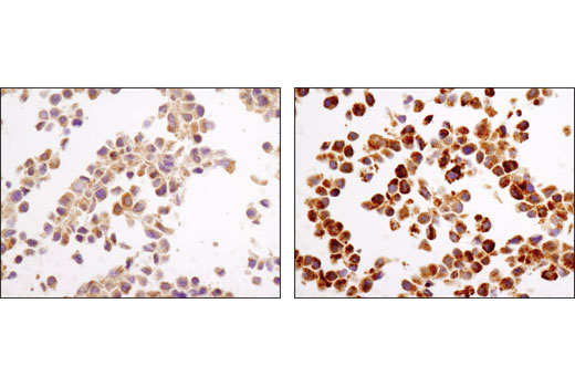 Immunohistochemical analysis of paraffin-embedded NIH/3T3 cell pellets, control (left) or chloroquine-treated (right), using LC3A/B (D3U4C) XP® Rabbit mAb.