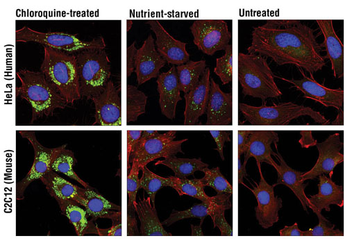Confocal immunofluorescent analysis of HeLa (upper) and C2C12 (lower) cells, chloroquine-treated (50 μM, overnight; left), nutrient-starved with EBSS (3 hr, middle) or untreated (right) using LC3A/B (D3U4C) XP ® Rabbit mAb (green) and β-Actin (13E5) Rabbit mAb (Alexa Fluor ® 555 Conjugate) #8046 (red). Blue pseudocolor= DRAQ5 ® #4084 (fluorescent DNA dye).