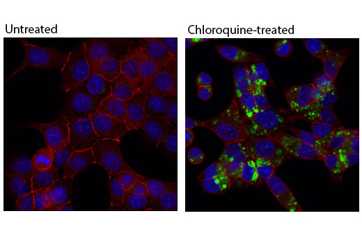 Immunohistochemical analysis of paraffin-embedded HeLa cell pellets, control (left) or choloroquine-treated (right), using LC3A (D50G8) XP ® Rabbit mAb.