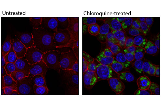 Confocal immunofluorescent analysis of HCT-116 cells, untreated (left) or choroquine-treated (50 uM, overnight; right) using LC3A/B Antibody (green) and β-Catenin (L54E2) Mouse mAb (Alexa Fluor® 555 Conjugate) #5612 (red). Blue pseudocolor = DRAQ5® #4084 (fluorescent DNA dye).