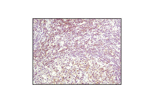 Immunohistochemical analysis of paraffin-embedded human tonsil using Lck (D88) XP ® Rabbit mAb.