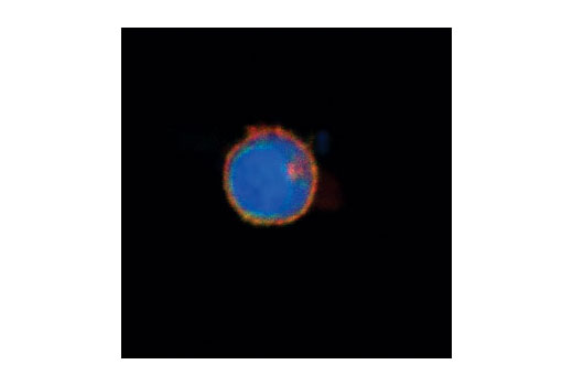 Confocal immunofluorescent analysis of a Jurkat cell nucleus using Lck (73A5) Rabbit mAb (red) and CD3 antibody (green). Blue=DRAQ5 ® #4084 fluorescent DNA dye.