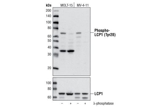 Western blot analysis of extracts from MOLT-15 and MV-4-11 cells, untreated or treated with λ-phosphatase, using Phospho-LCP1 (Tyr28) Antibody (upper) and LCP1 Antibody #5350 (lower).