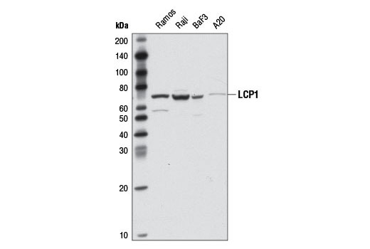 Western blot analysis of extracts from various cell lines using LCP1 (D1C3) Rabbit mAb.