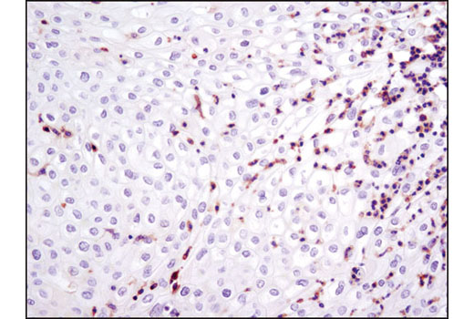 Immunohistochemical analysis of paraffin-embedded human breast carcinoma using LCP1 (D1C3) Rabbit mAb.