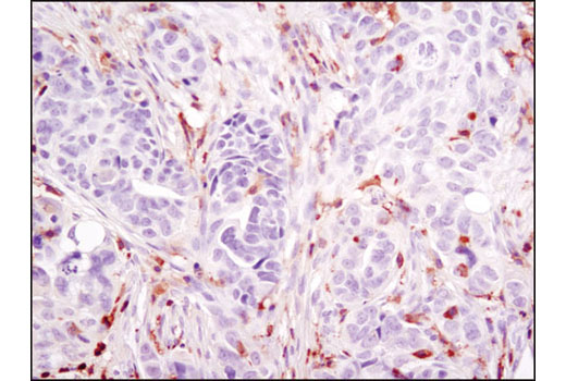Immunohistochemical analysis of paraffin-embedded human ovarian carcinoma using LCP1 (D1C3) Rabbit mAb.