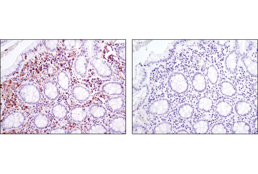 Immunohistochemical analysis of paraffin-embedded human colon using LCP1 (D1C3) Rabbit mAb in the presence of control peptide (left) or antigen-specific peptide (right).