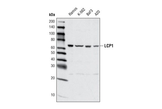 Western blot analysis of extracts from various cell lines using LCP1 Antibody.