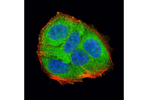 Confocal immunofluorescent analysis of MCF-7 cells using LDHA (C4B5) Rabbit mAb (green). Actin filaments have been labeled with DY-554 phalloidin (red). Blue pseudocolor = DRAQ5 ® #4084 (fluorescent DNA dye).