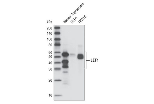 Western blot analysis of total cell lysates from mouse thymocytes, DLD1 and HCT15 cells, using LEF1 (C18A7) Rabbit mAb.