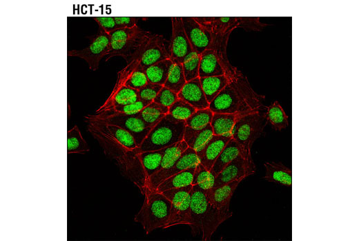 Confocal immunofluorescent analysis of HCT-15 cells using LEF1 (C12A5) Rabbit mAb (green). Actin filaments have been labeled with DyLight™ 554 Phalloidin #13054 (red).
