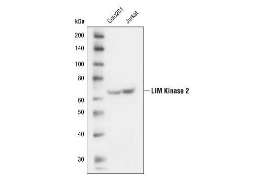 Western blot analysis of extracts from Colo201 and Jurkat cells, using LIMK2 (8C11) Rabbit mAb.