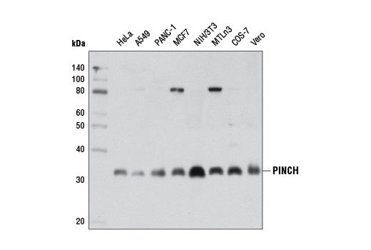 Western blot analysis of extracts from various cell lines using PINCH (5G7) Mouse mAb.