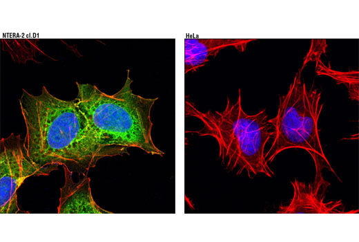 Confocal immunofluorescent analysis of NTERA-2 cl.D1 (left) and HeLa (right) cells using LIN28A (D9F5) Rabbit mAb (green). Actin filaments were labeled with DY-554 phalloidin (red). Blue pseudocolor = DRAQ5 ® #4084 (fluorescent DNA dye).