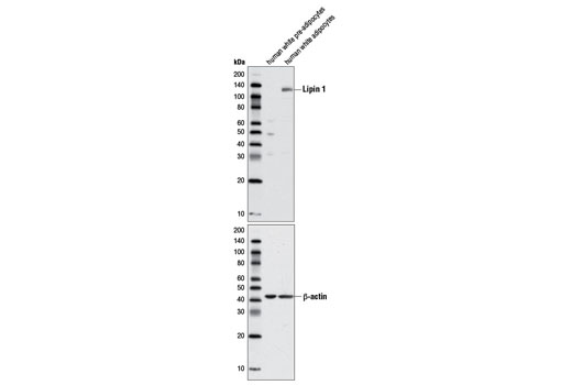 Western blot analysis of extracts from human white pre-adipocytes and human white adipocytes using Lipin 1 Antibody (upper) and β-Actin Antibody #4967 (lower).