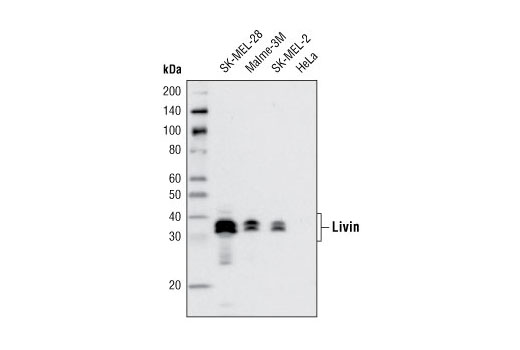 Western blot analysis of extracts from various cell lines using Livin (D61D1) XP ® Rabbit mAb.