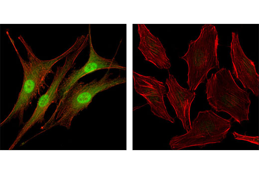 Confocal immunofluorescent analysis of SK-MEL-28 cells (left) and HeLa cells (right) using Livin (D61D1) XP ® Rabbit mAb (green). Actin filaments were labeled with DY-554 phalloidin (red).