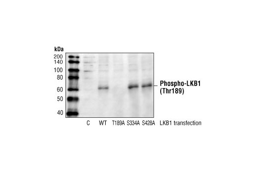 Western blot analysis of extracts from COS cells, untransfected or transfected with Wild-type LKB1, LKB1 (T189A), LKB1 (S334A) or LKB1 (S428A), using Phospho-LKB1 (Thr189) Antibody .