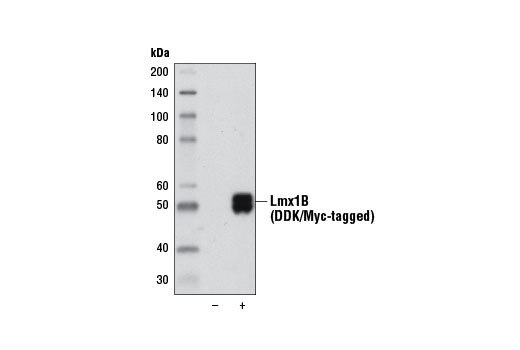 Western blot analysis of extracts from 293T cells, mock transfected (-) or transfected with a construct expressing DDK/Myc-tagged full-length human Lmx1B protein (hLmx1B-DDK/Myc; +), using Lmx1B (D1E2) Rabbit mAb.