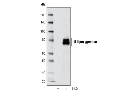 Western blot analysis of extracts from COS cells transfected with 5-LO using 5-Lipoxygenase (49G1) Rabbit mAb.