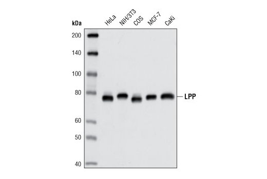 Western blot analysis of extracts from various cell types using LPP (8B3A110) Mouse mAb.