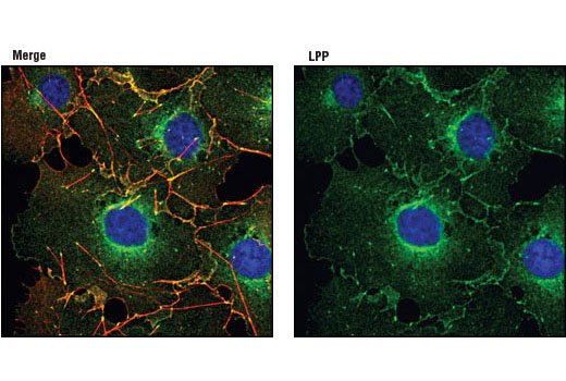Confocal immunofluorescent analysis of COS cells using LPP (8B3A11) Mouse mAb (green). Actin filaments have been labeled using DY-554 phalloidin (red). Blue pseudocolor = DRAQ5™ (fluorescent DNA dye).