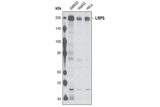 Western blot analysis of extracts from various cell lines using LRP5 (D23F7) Rabbit mAb.