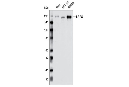 Western blot analysis of extracts from HeLa, HCT 116, and SW620 cells using LRP5 (D80F2) Rabbit mAb.