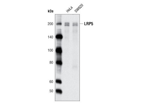 Western blot analysis of extracts from HeLa and SW620 cells using LRP5 (D5G4) Rabbit mAb.