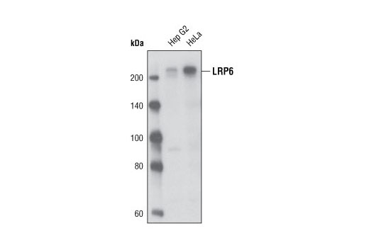 Western blot analysis of extracts from Hep G2 and HeLa cells using LRP6 (C47E12) Rabbit mAb.